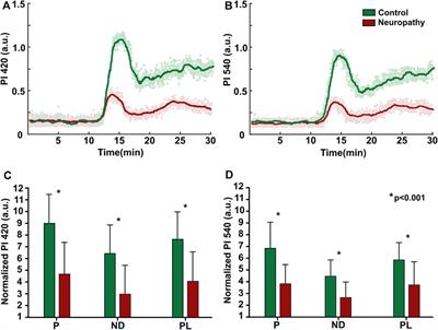 Contactless photoplethysmography for assessment of small fiber neuropathy